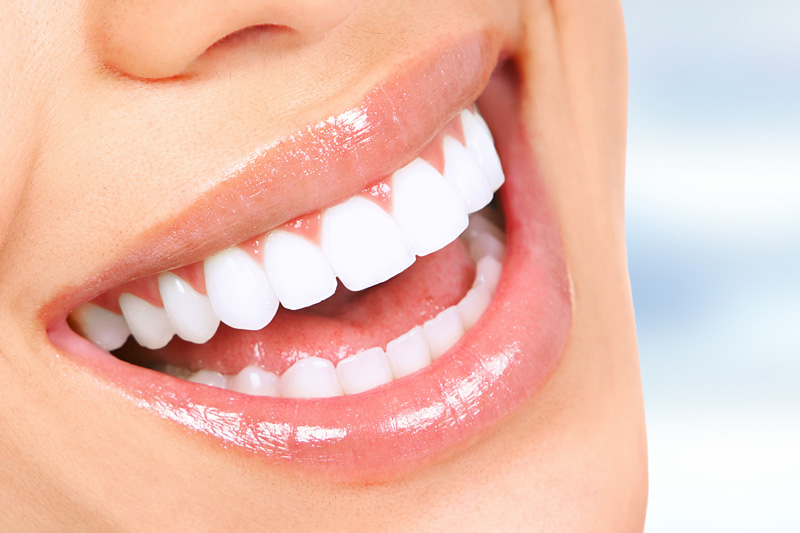 Cosmetic Dentistry in Reno