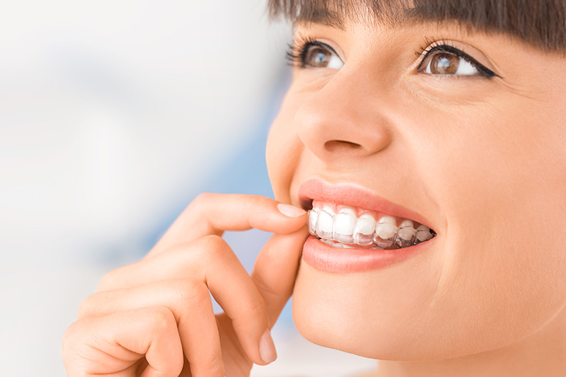 SureSmile Clear Aligners in Reno